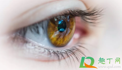 上眼皮倒睫有什么办法(眼角下睫毛倒睫怎么办)