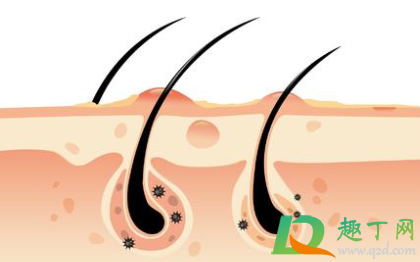 后脑勺头皮长疙瘩是什么原因(后脑勺头皮长很多疙瘩)