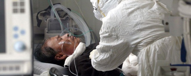 非典的症状有哪些(非典的典型症状有哪些)