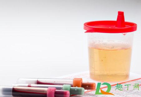 女性喝完水一会就尿正常吗(女人喝水一会就尿什么原因)