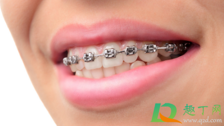 带牙套是不是要把牙齿磨掉一半(磨牙会不会把牙套磨掉) 带牙套是不是要把牙齿磨掉一半(磨牙会不会把牙套磨掉)