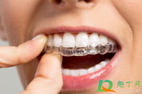 带牙套是先排齐再收缝吗(戴牙套收缝是最后一步骤了吗)