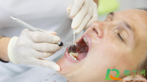 牙周炎怎么治疗(牙周炎怎么治疗最有效)