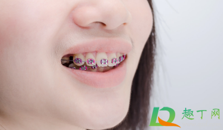 带牙套吃东西老塞在牙套里怎么办 带牙套吃东西老塞在牙套里怎么办