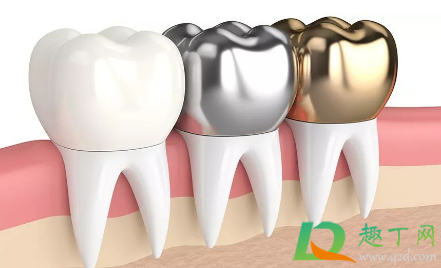 为什么上下牙套不能同时戴上(只戴上牙套不戴下牙套有影响吗) 为什么上下牙套不能同时戴上(只戴上牙套不戴下牙套有影响吗)