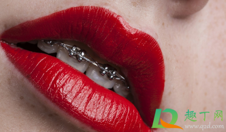 为什么上下牙套不能同时戴上(只戴上牙套不戴下牙套有影响吗) 为什么上下牙套不能同时戴上(只戴上牙套不戴下牙套有影响吗)