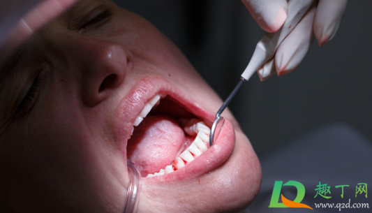 牙周炎怎么治疗(牙周炎怎么治疗最有效)