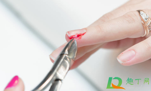 手指上长倒刺很可能是因为啥(手指上长倒刺很可能是因为什么造成的)