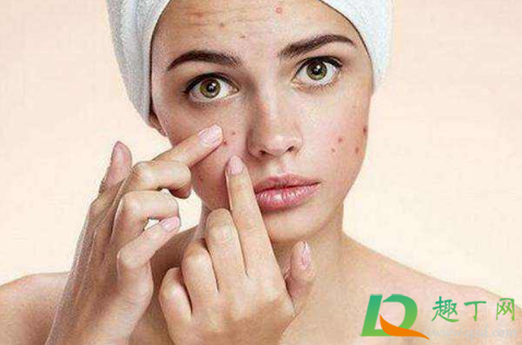 三角区的痘痘挤了一定会感染吗(不是三角区的痘痘挤了会有危险吗) 三角区的痘痘挤了一定会感染吗(不是三角区的痘痘挤了会有危险吗)