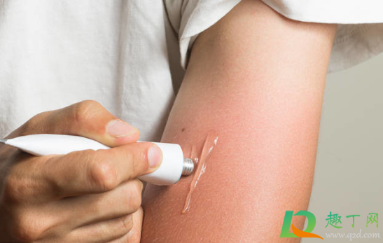 开水烫伤怎么办(水被开水烫伤怎么办) 开水烫伤怎么办(水被开水烫伤怎么办)