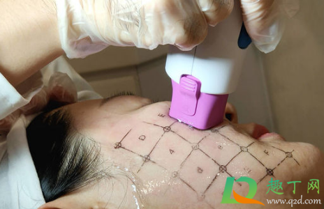 热玛吉做一次可以保持多久(热玛吉做一次可以保持多久知乎) 热玛吉做一次可以保持多久(热玛吉做一次可以保持多久知乎)