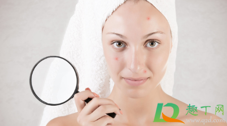 为什么挤痘痘会引起颅内感染(什么情况下挤痘痘会引起颅内感染) 为什么挤痘痘会引起颅内感染(什么情况下挤痘痘会引起颅内感染)