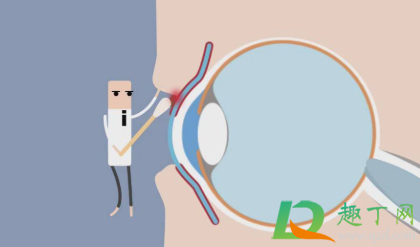 眼角痒是怎么回事越揉越痒(眼睛内眼角痒是怎么回事越揉越痒) 眼角痒是怎么回事越揉越痒(眼睛内眼角痒是怎么回事越揉越痒)