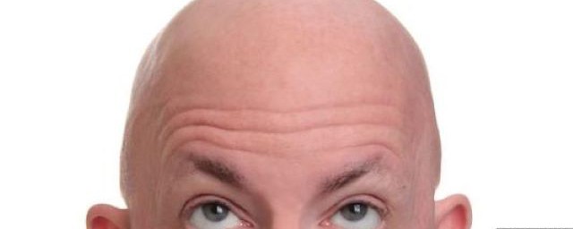 可以不可以剃头来增发(把头发剃秃了,能增发么)