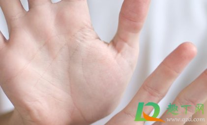 手心出汗是怎么回事(手心一直出汗什么原因) 手心出汗是怎么回事(手心一直出汗什么原因)