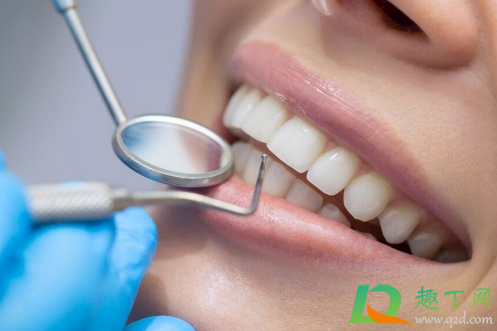 洗牙能让牙变白吗(洗牙就能变白吗)