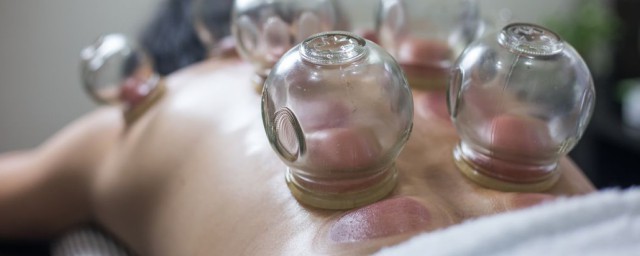 拔火罐的好处(拔火罐的好处和坏处大揭秘)
