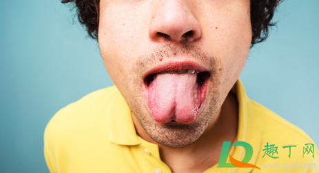 舌苔厚黄是怎么回事(舌苔厚腻发黄怎么回事)