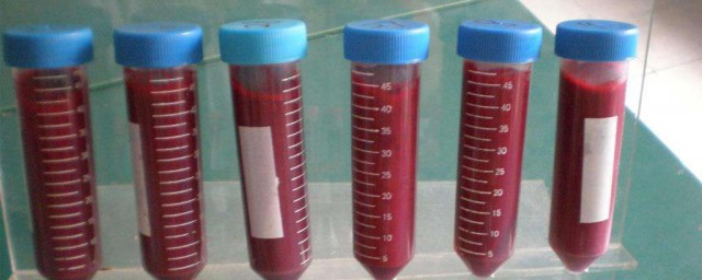 血清的主要成分是什么(血清的成分及其主要作用)