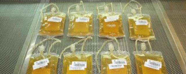 血浆的简单介绍(血浆的分类)