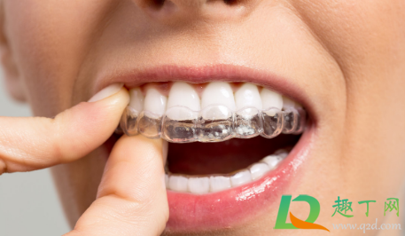 带牙套一边疼一边不疼可以吃饭吗(戴牙套什么时候可以吃饭 不痛了)