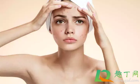 为什么挤痘痘会引起颅内感染(什么情况下挤痘痘会引起颅内感染) 为什么挤痘痘会引起颅内感染(什么情况下挤痘痘会引起颅内感染)