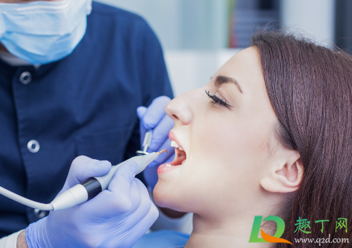 洗牙能让牙变白吗(洗牙就能变白吗) 洗牙能让牙变白吗(洗牙就能变白吗)