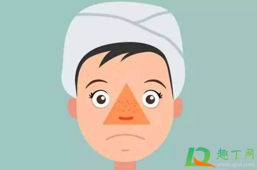 三角区域的痘痘挤了会怎么样(为什么挤三角区的痘痘很危险) 三角区域的痘痘挤了会怎么样(为什么挤三角区的痘痘很危险)