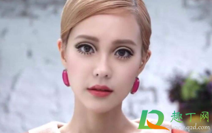 年轻人眼白发黄是怎么回事(青年眼白发黄是怎么回事)