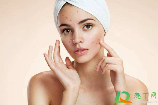 三角区的痘痘挤了一定会感染吗(不是三角区的痘痘挤了会有危险吗) 三角区的痘痘挤了一定会感染吗(不是三角区的痘痘挤了会有危险吗)