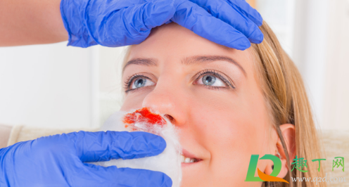 鼻子出血是什么原因(鼻子出血是什么原因鼻涕里带血怎么办) 鼻子出血是什么原因(鼻子出血是什么原因鼻涕里带血怎么办)