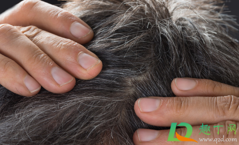 白头发会越拔长得越多吗(白头发会越拔长得越多吗?会还是不会)