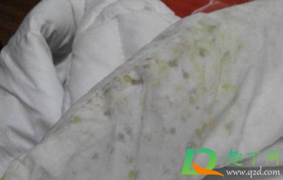 黑色羽绒服起霉点怎么洗掉(羽绒服上有发霉的黑点干洗时能处理)