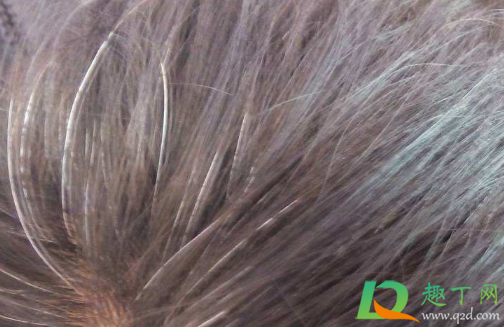 白头发会越拔长得越多吗(白头发会越拔长得越多吗?会还是不会)