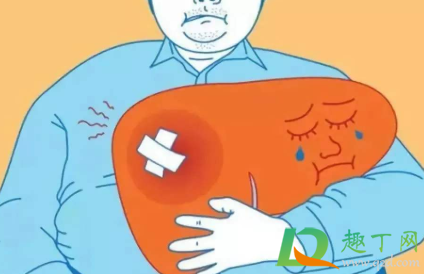 脂肪肝是怎么回事严重吗(脂肪肝是咋回事,严重吗)