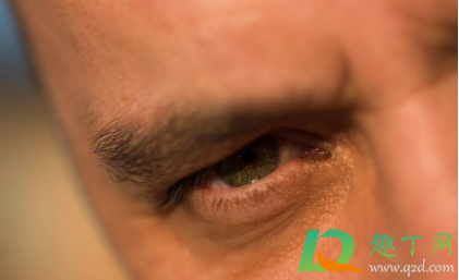 眼睛有红血丝怎么缓解(怎么缓解眼里的红血丝)