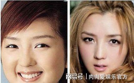孙菲菲整容失败，李菲菲(孙菲菲什么时候整的容)