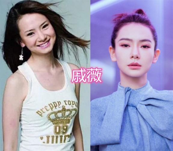 戚薇整容，李乐祺是双眼皮吗(戚薇 双眼皮)