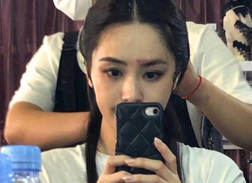 范玮琪回应摔伤，摔伤照片(范玮琪哭了)