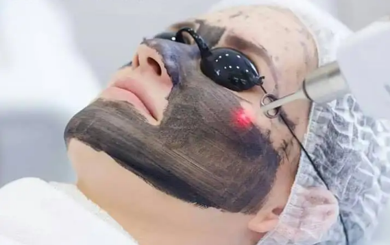 黑脸娃娃的危害是什么(黑脸娃娃对皮肤有伤害吗)