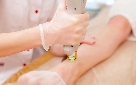 激光脱毛可以脱脸上的汗毛吗(激光脱毛可以出汗吗) 激光脱毛可以脱脸上的汗毛吗(激光脱毛可以出汗吗)