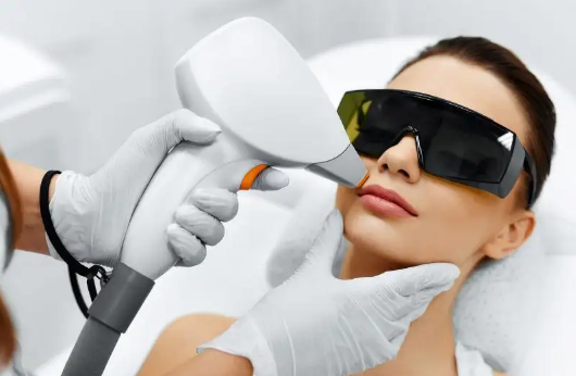 激光脱毛可以脱脸上的汗毛吗(激光脱毛可以出汗吗)