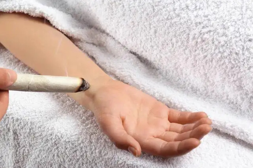 2022年三伏天艾灸时间表(今年三伏艾灸时间) 2022年三伏天艾灸时间表(今年三伏艾灸时间)