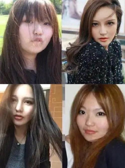 周扬青整容，周扬青不自然(周青扬整容了吗)