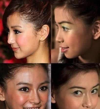 杨颖整容前后照片,baby整容前(杨颖整容前图片)