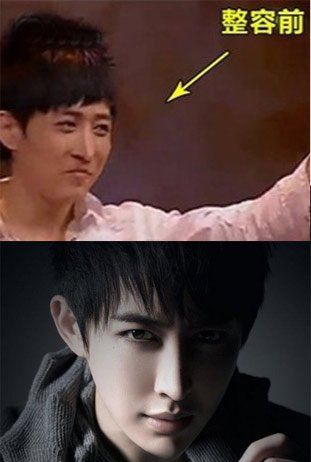 魔术师yif整容,yif为什么退(yif为什么退出魔术)