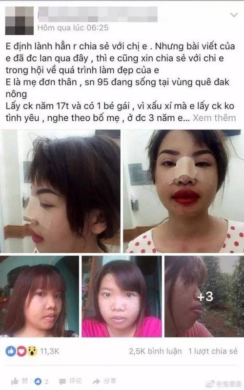 凤姐整容前照片，凤姐现状,她居然(凤姐怎么样了)