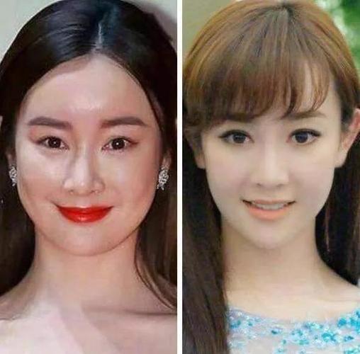 郑爽整容前后照片,整容明星整容前(郑爽整容整了哪些部位) 郑爽整容前后照片,整容明星整容前(郑爽整容整了哪些部位)