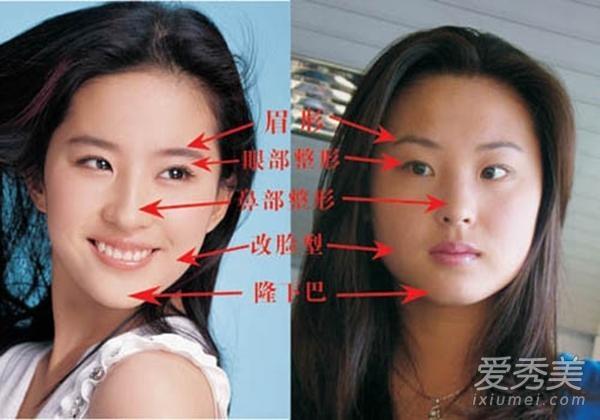 金南珠整容前,金南珠主演电视剧(金南珠演技)