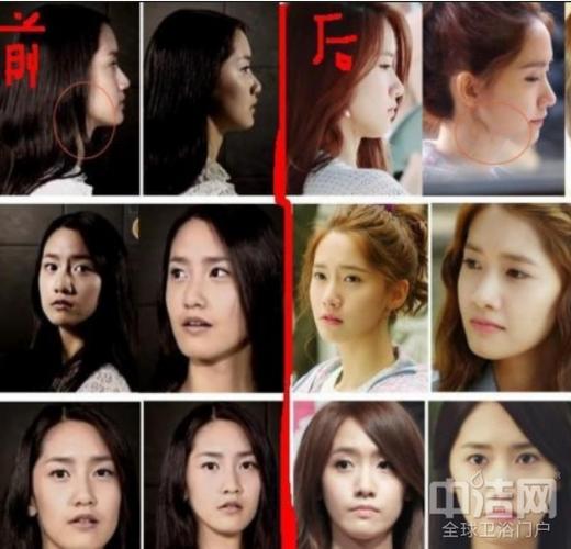 林允儿整容,全球最美100张面孔(林允最美面孔排名)